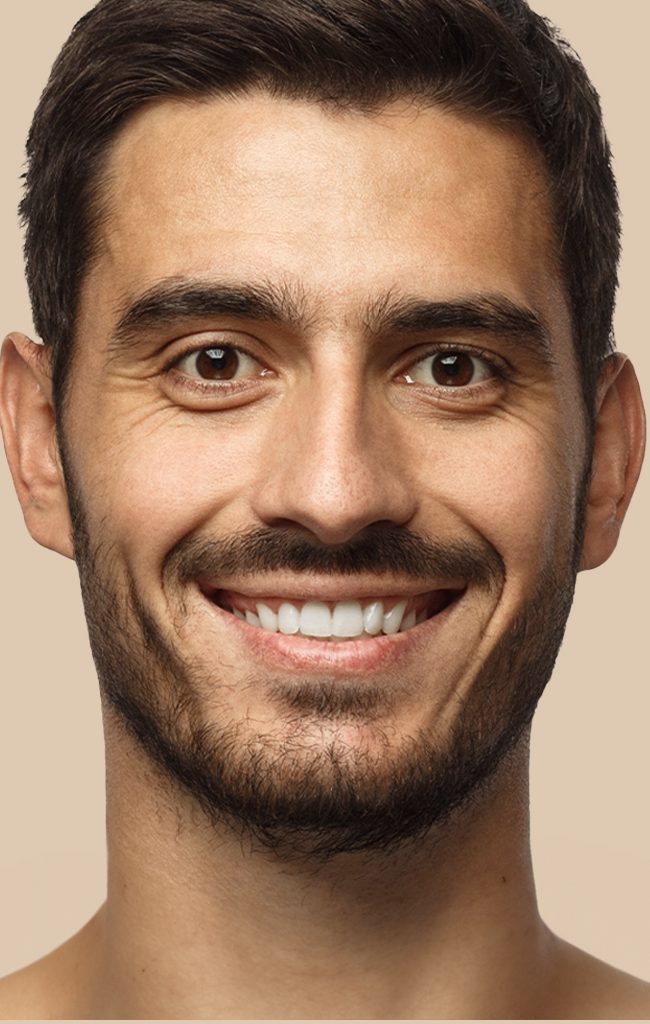 Otoplasty