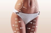 Best-Fat-Transfer-Surgeons-in-Abu-Dhabi-Al-Ain-Enfield-Royal