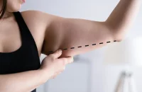arm-lift-surgery