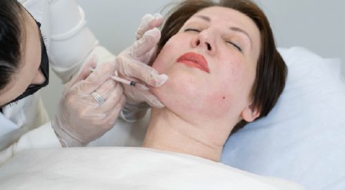 double-chin-reduction2