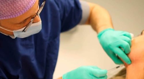 double-chin-reduction7